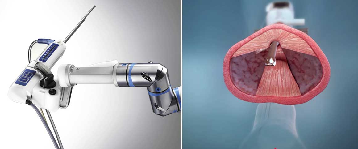 수술 기구 사진와 수술 사진