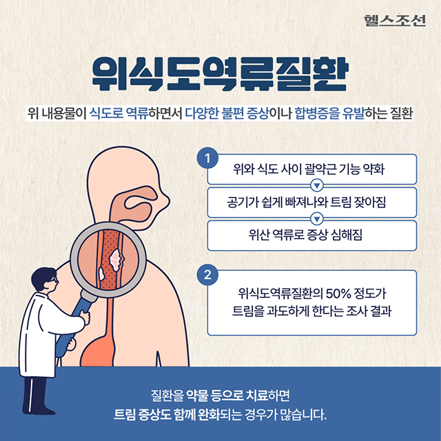위식도역류질환