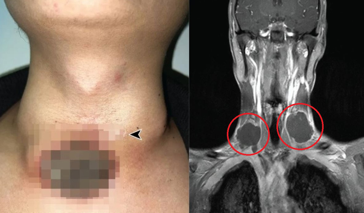 남성의 수술 전 사진