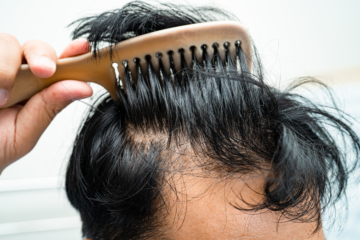 Z세대, 머리 ‘이렇게’ 감는다던데… 탈모 부르는 방법?