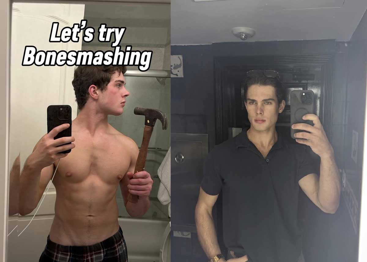 망치로 얼굴을 내려치더니… 이유가 “잘 생겨지려고”?