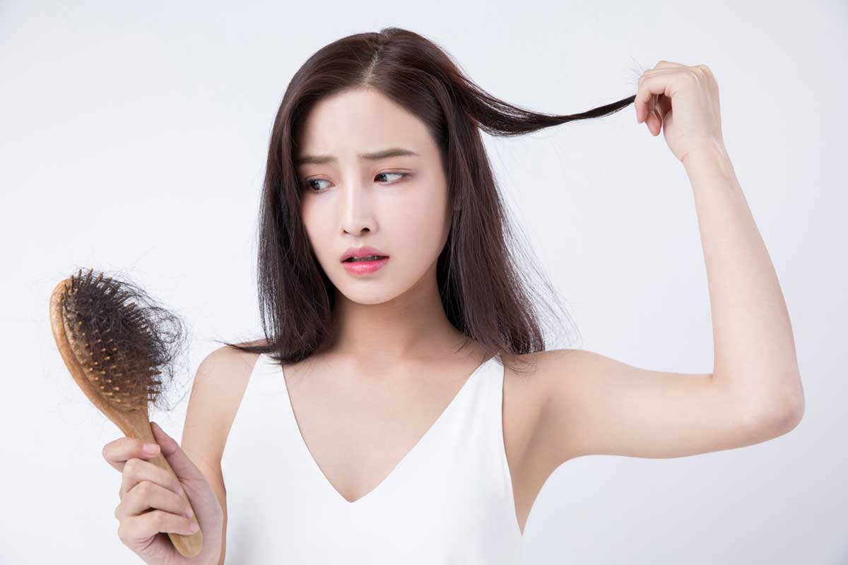 탈모 있는 여성 사진