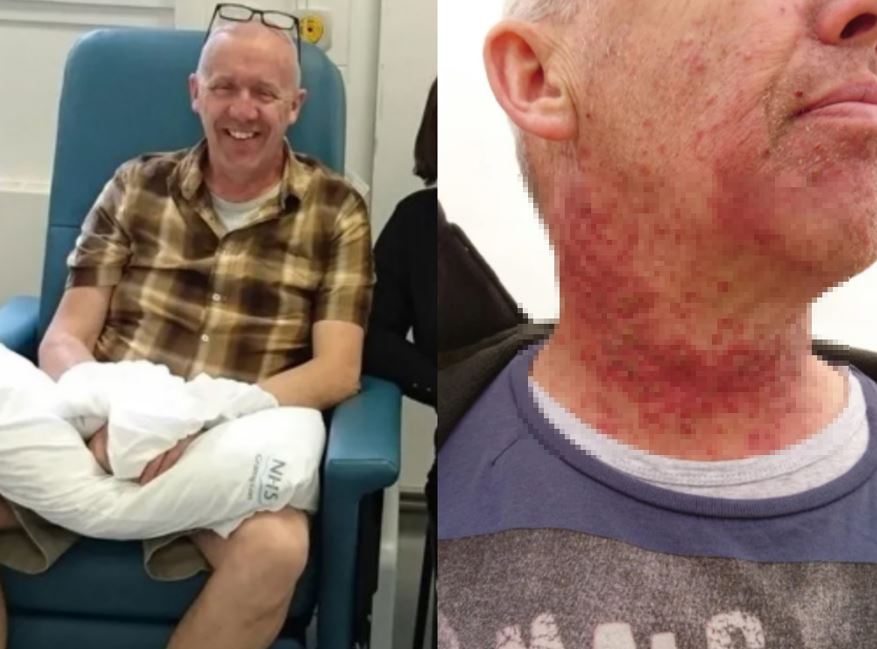 외국인 남성과 목 사진