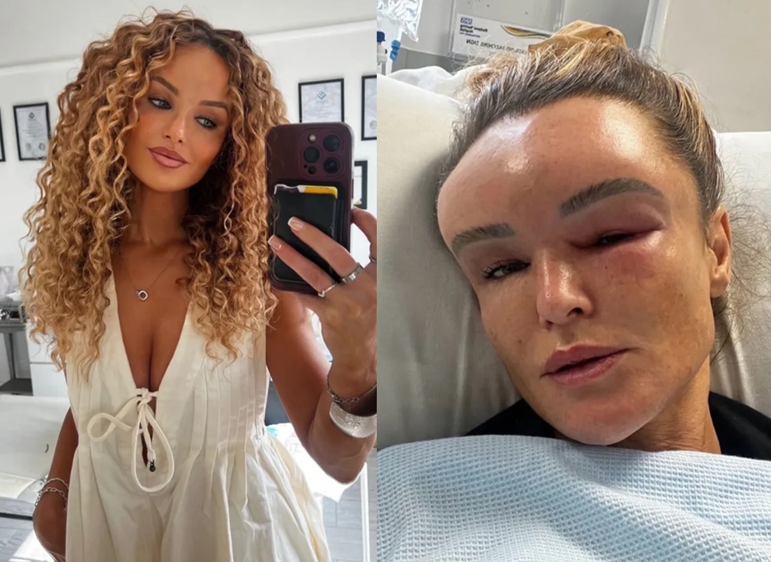 클레어 티터링턴