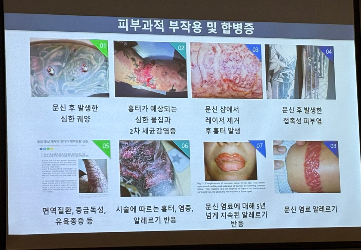 부작용 자료사진