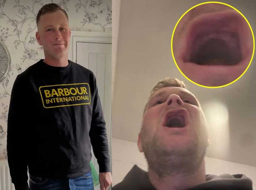 치아 잃은 남성