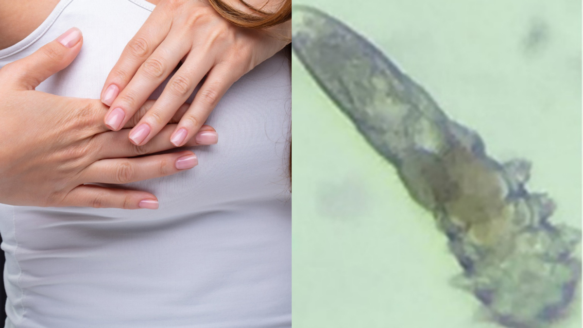 가슴통증과 벌레