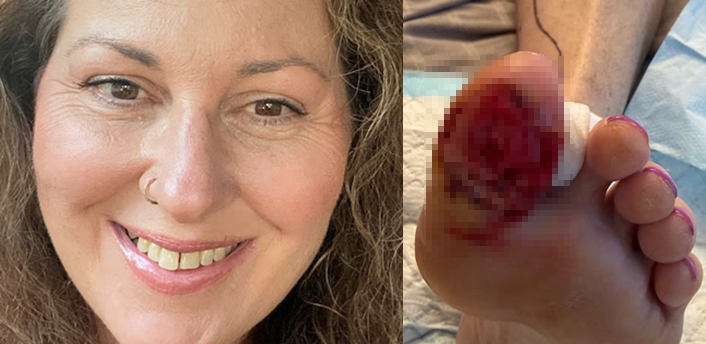 카일라 윌콕스 사진, 엄지발가락 사진