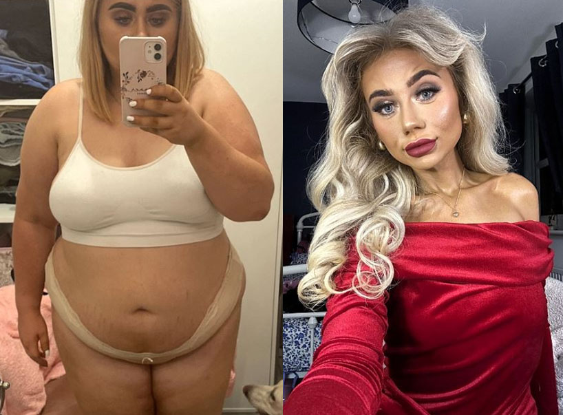 다이어트 전후 여성