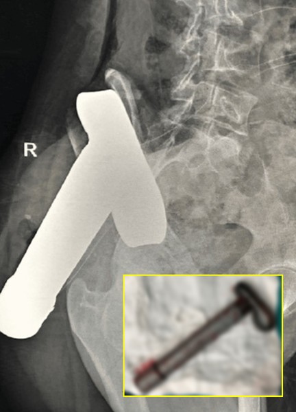 영상 검사 사진