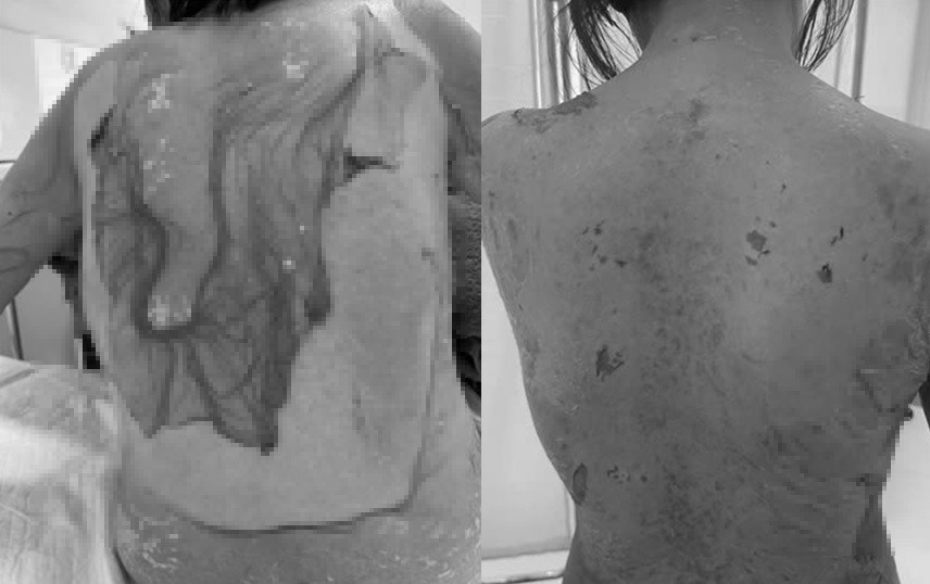 해당 사례의 여성