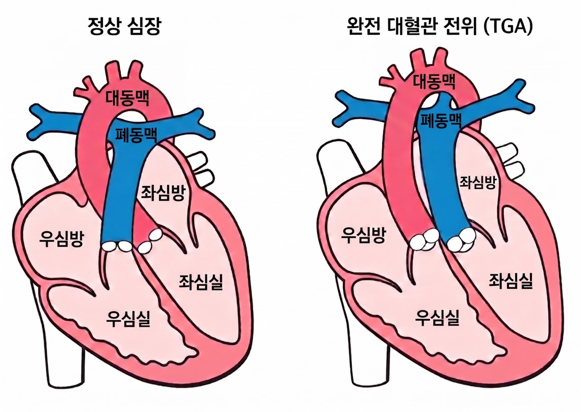 심장 이미지