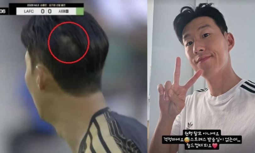 손흥민