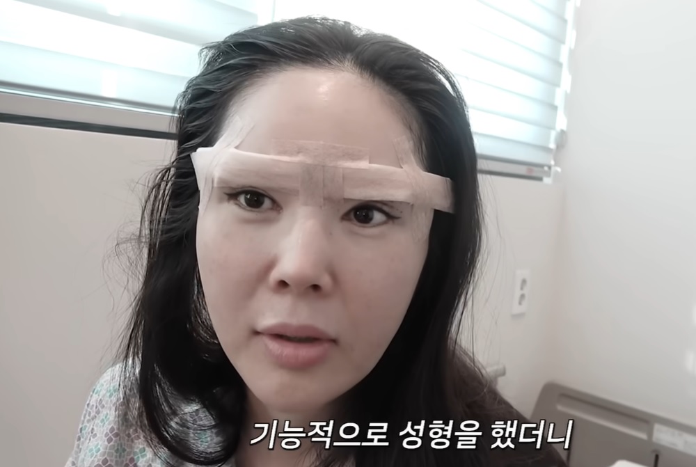 장영란
