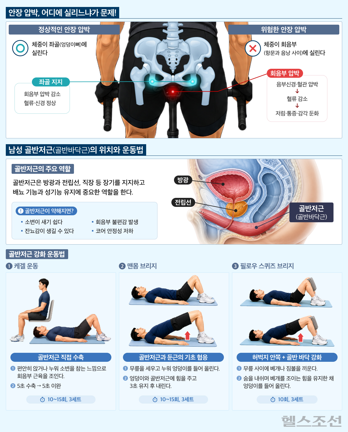 골반저근 그래픽