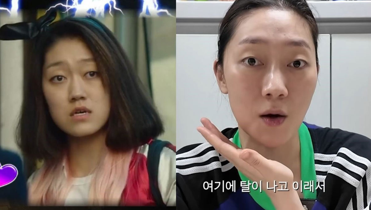 불규칙한 치열, 외모만 문제 아냐… 박경혜가 양악수술 받은 이유는?