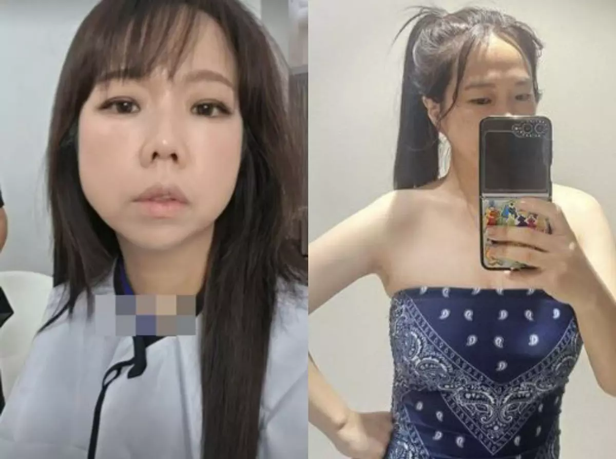 이미지