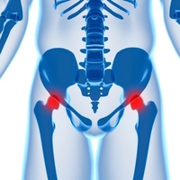 "�ٰ����� ������ ������ ����ȯ�� ����� ����"