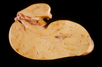 ���ϵ� ���ϸ� ���衦 ���氣 �����ϴ� �Ļ����?