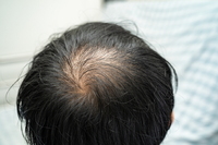 Ż�� �����Ϸ��顦 ��ħ vs ���� ���� �Ӹ� ���ƾ� �ұ�?