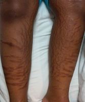 �ٸ��� �� ������� ����� ��ȯ�� ��Ƴ� �� �ִ� [1�� �ǰ�üũ..