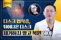 [������� TV] Ƣ��� �Ű� ������ ��ũ, �����ؾ� �ұ�?