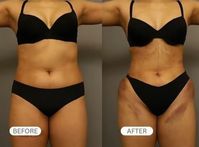 ���㸮 �߷��� ���̷�, ���� ���� ���ż� ������ �α⡱ ��ݡ���..