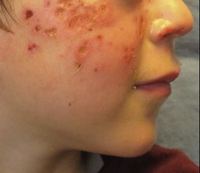 ���� �Ǻο� ���� �ڱ��� ���δٸ顦 ���޺� �˷����⡯ ����Ű��..