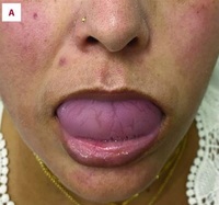 ���� ½½ ������, ��� ���롱�� �� ���� ��300���� �δ� ���� ..