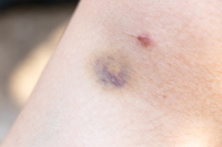 �� �� ��� ����, ���� �࡯ ������ ����