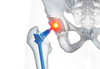 �ΰ����� ����, �����񺸴� ����� ������ ���������� ���� �� ��..