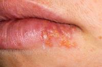 ��� ����ϴ� �Լ� �츣�佺 ������ ����ٸ� ���̰͡� �弼��