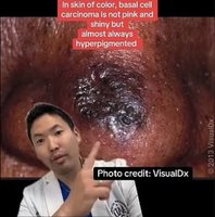 �����帧�� �� �˾Ҵµ�, �Ǻξϡ� �����ǰ� ���� ��� ��ȣ��?