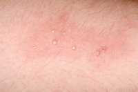 �Ű��� ���� ���� �� ����߸��⵵�� ������� �� �ɸ�����?