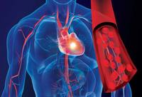 �ɱٰ�� ������, ���׾� ���� ����