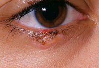 ���Լ��� ���� ����� �� �Ƴ�?�� �츣�佺 ���̷���, ���� ����..