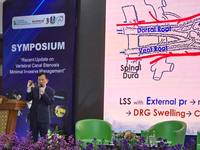 "���� ���� ������ ġ��"�� ������ ���� Moon ī����, ������ ��..