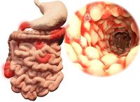 ���� ������, �Ҿ� ũ�к� ġ�� ȿ�� �ش�ȭ ���� ��ǥ