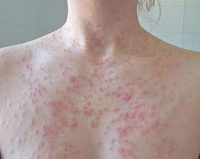 ȣ   㰬ٰ   ϡ,  ô?