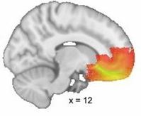 �Ӹ� ��ġ��, ������ �� 17���� ���������� ���̰��� �ջ� Ȯ�ε�..