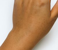 ���� �ٳ���� �յ ������ ������ ����ٴ� ����顦 ���� ��..