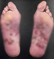 ���չ߿� ��� ��� �����̡��� ������ �ߺ� ���� ū ���� ��ͺ�..