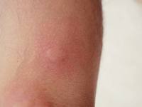 ���ѱ��� ���� Ȯ���ڰ����� ��š�ġ���� ���� ���� ����, �� ��..