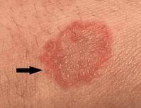 �Ǻ��� ���� ��硯 ������ �ϱ��� �̾����� ���̷��� ���� ��ȣ..