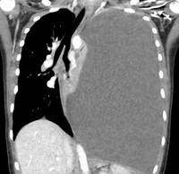 ������� ���� �� �ջ�, �幰���µ����� ���� 14�� �ҳ�, ���̰�..