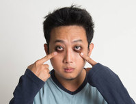 “내 다크서클은 무슨 색?” 색깔 따라 추정 원인 달라… 개선법 의외..