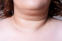 목에 ‘이것’ 보인다면… “살 빼라”는 몸의 경고일 수도