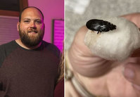 “귀에서 자꾸 소리가…” 정신이상자로 오해받은 男, 귓속서 나온 건..