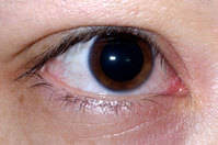 눈 혈관 모양 ‘이런’ 사람, 심장병 위험 커