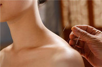 “교통사고 후 침 맞다가 척수 손상” 대체 무슨 일?